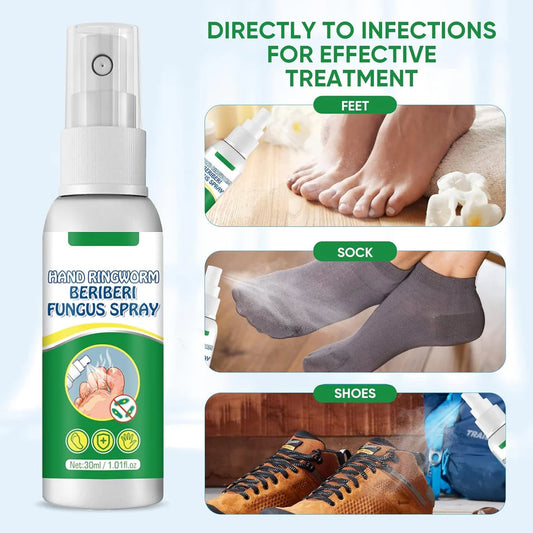 Hand Ringworm Beriberi Fungus Spray (Original)